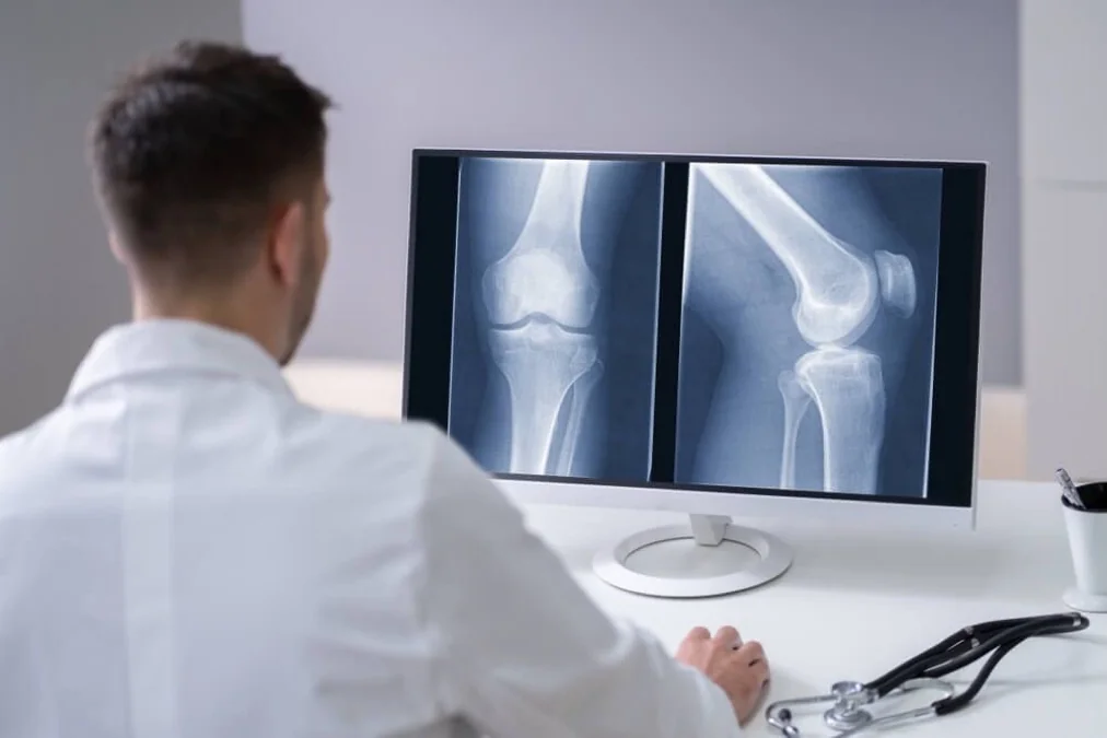 Doctor reviewing knee X-ray images on a monitor